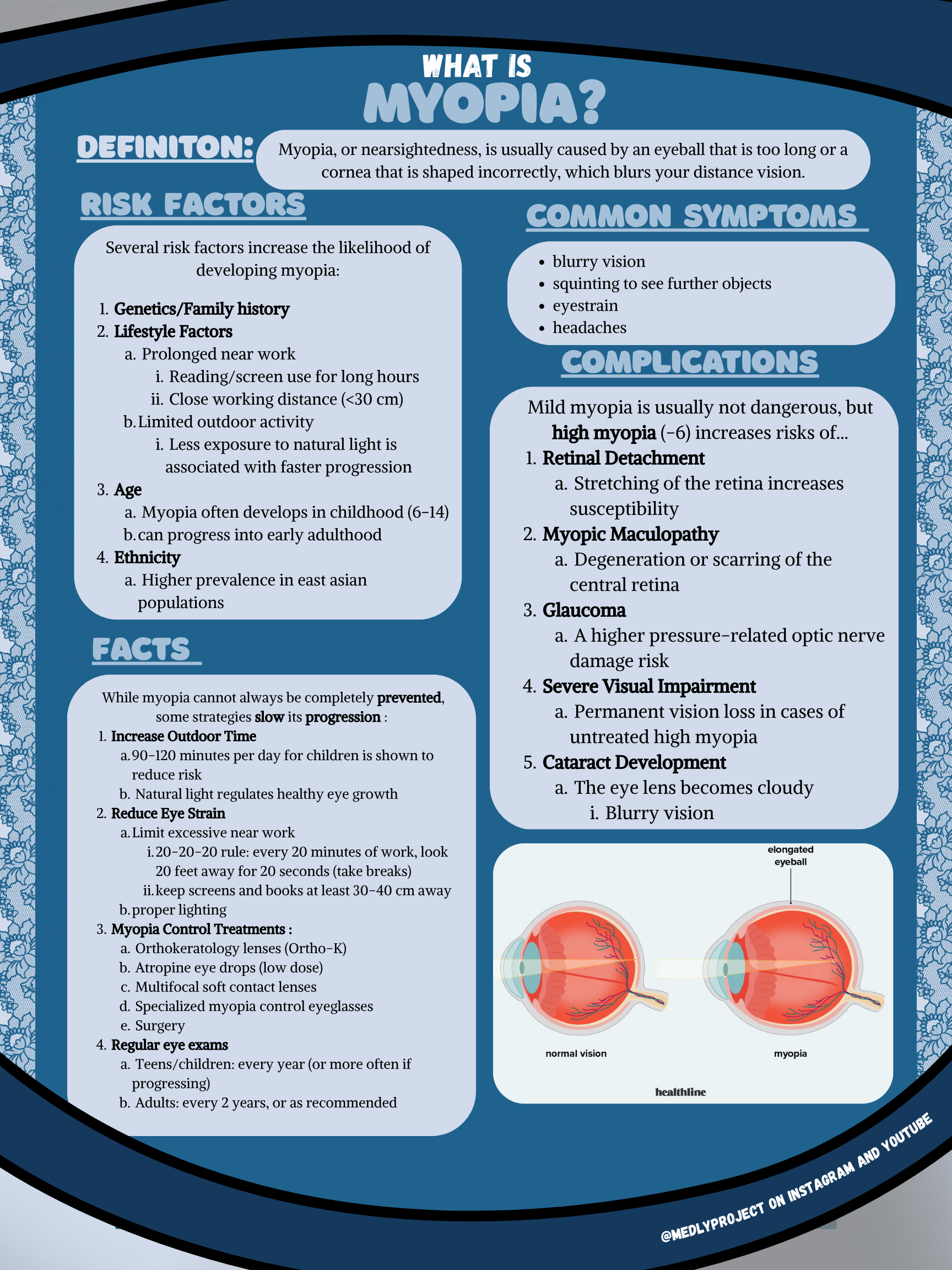 Myopia preview